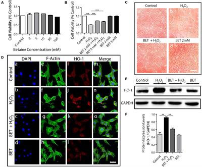 Highly Water-Preserving Zwitterionic Betaine-Incorporated Collagen Sponges With <mark class="highlighted">Anti-oxidation</mark> and Anti-inflammation for Wound Regeneration